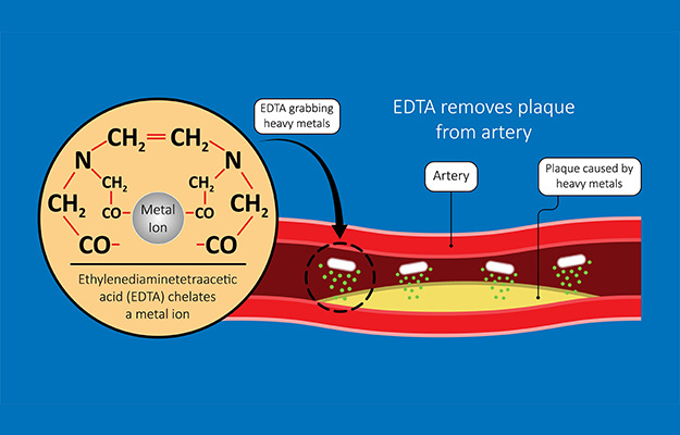 Chelation-Therapy-lead-mercury-iron-arsenic-ethylenediaminetetraacetic-acid-bloodstream-EDTA-Chelation-Therapy