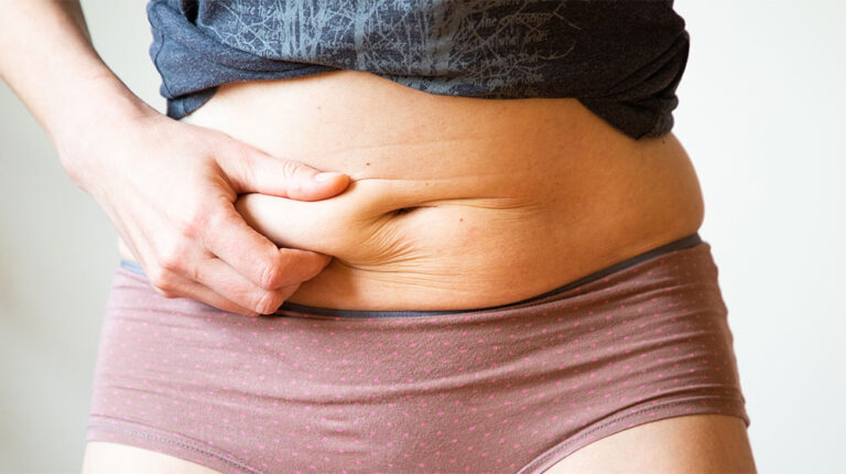 woman-checking-belly-fat-loose-weight-concept-Understanding-Sarcopenic-Obesity-and-Its-Effect-on-Longevity