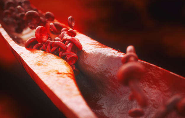 Small-Vessels-3D-render-What-Is-A-Microvascular-Disease
